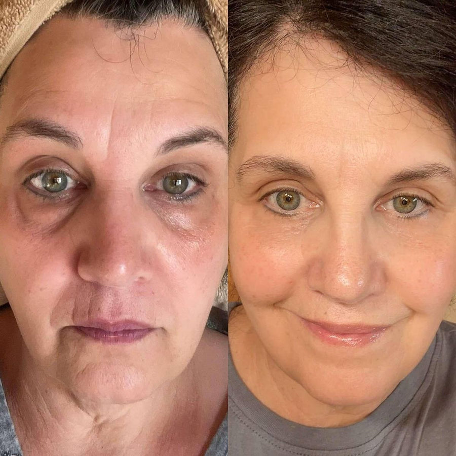 Resultado antes y después