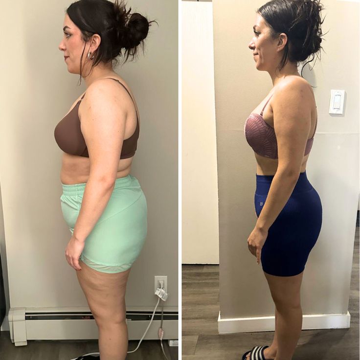 Resultado antes y después